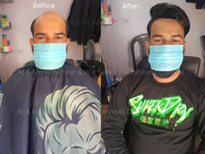 Wig & Hair Patch Services in Chinhat