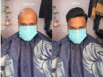 Wig & Hair Patch Services in Chinhat