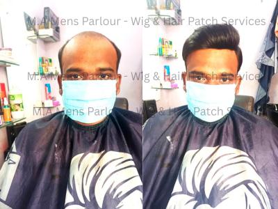 Wig & Hair Patch Services in Chinhat